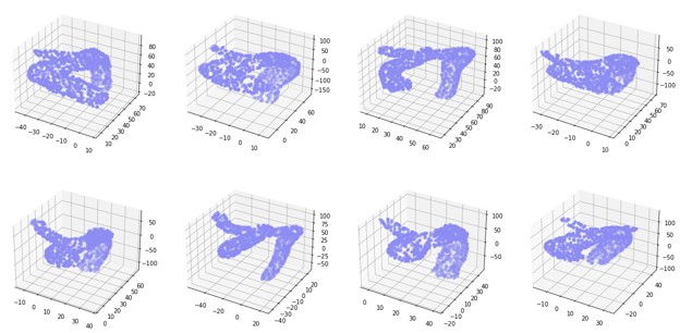 Visual of the eight point clouds of patient aortas as described in the motivation and data sections